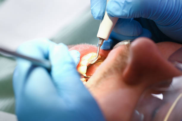 Best Tooth Infection Emergency Dentist  in Crystal Lake, FL