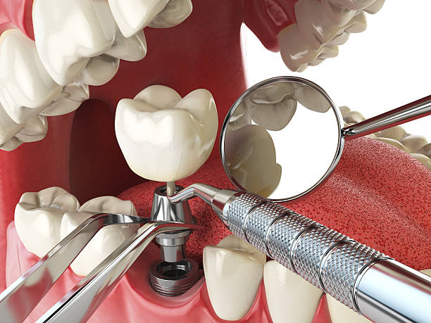 Best Emergency Dentist Near Me  in Crystal Lake, FL